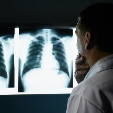Doctor looking at x-ray of lungs